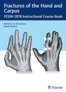 Fractures of the Hand and Carpus : FESSH 2018 Instructional Course Book