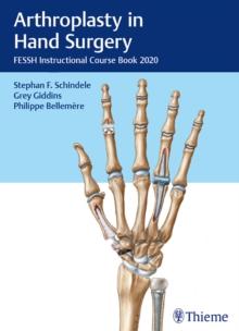 Arthroplasty in Hand Surgery : FESSH Instructional Course Book 2020