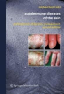 Autoimmune Diseases of the Skin : Pathogenesis, Diagnosis, Management