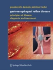 Gastroesophageal Reflux Disease : Principles of Disease, Diagnosis, and Treatment