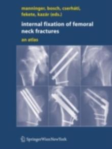 Internal fixation of femoral neck fractures : An Atlas