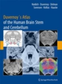 Duvernoy's Atlas of the Human Brain Stem and Cerebellum : High-Field MRI, Surface Anatomy, Internal Structure, Vascularization and 3 D Sectional Anatomy