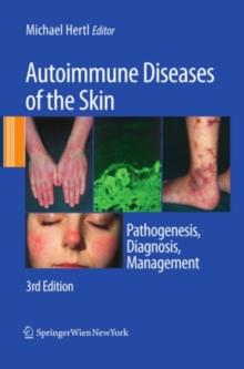 Autoimmune Diseases of the Skin : Pathogenesis, Diagnosis, Management