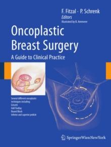 Oncoplastic Breast Surgery : A Guide to Clinical Practice