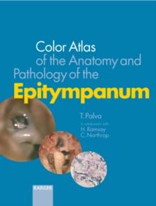 Color Atlas of the Anatomy and Pathology of the Epitympanum