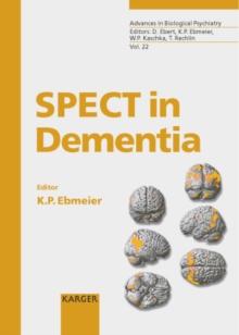 SPECT in Dementia