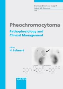 Pheochromocytoma : Pathophysiology and Clinical Management.