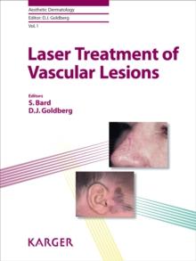 Laser Treatment of Vascular Lesions