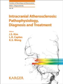 Intracranial Atherosclerosis: Pathophysiology, Diagnosis and Treatment