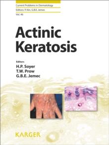 Actinic Keratosis