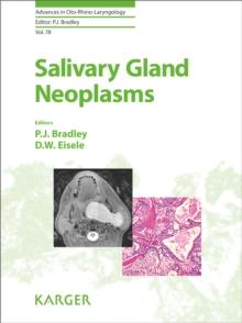 Salivary Gland Neoplasms