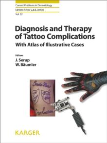 Diagnosis and Therapy of Tattoo Complications : With Atlas of Illustrative Cases.