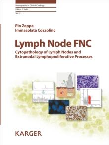 Lymph Node FNC : Cytopathology of Lymph Nodes and Extranodal Lymphoproliferative Processes.