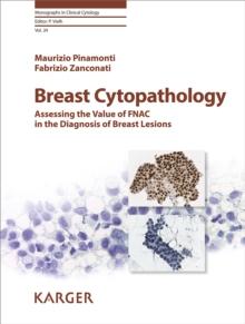 Breast Cytopathology : Assessing the Value of FNAC in the Diagnosis of Breast Lesions.