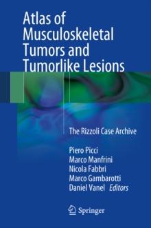 Atlas of Musculoskeletal Tumors and Tumorlike Lesions : The Rizzoli Case Archive