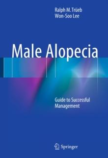 Male Alopecia : Guide to Successful Management