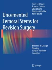 Uncemented Femoral Stems for Revision Surgery : The Press-fit Concept - Planning - Surgical Technique - Evaluation