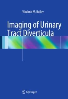 Imaging of Urinary Tract Diverticula