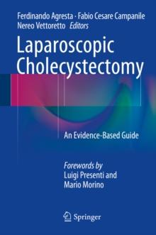 Laparoscopic Cholecystectomy : An Evidence-Based Guide