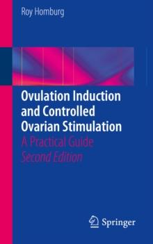 Ovulation Induction and Controlled Ovarian Stimulation : A Practical Guide