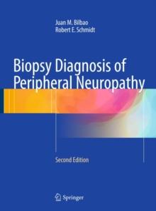 Biopsy Diagnosis of Peripheral Neuropathy