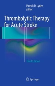 Thrombolytic Therapy for Acute Stroke