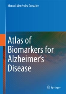 Atlas of Biomarkers for Alzheimer's Disease