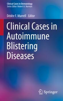 Clinical Cases in Autoimmune Blistering Diseases