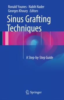 Sinus Grafting Techniques : A Step-by-Step Guide