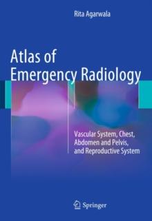 Atlas of Emergency Radiology : Vascular System, Chest, Abdomen and Pelvis, and Reproductive System