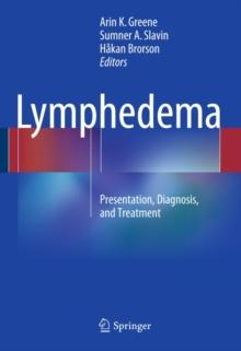 Lymphedema : Presentation, Diagnosis, and Treatment