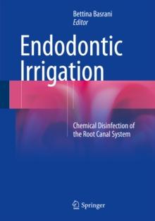 Endodontic Irrigation : Chemical disinfection of the root canal system