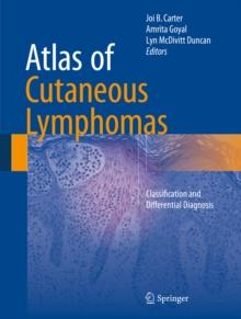 Atlas of Cutaneous Lymphomas : Classification and Differential Diagnosis