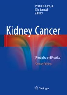 Kidney Cancer : Principles and Practice