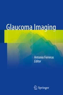 Glaucoma Imaging