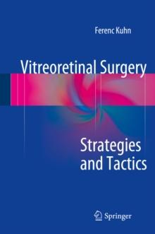 Vitreoretinal Surgery: Strategies and Tactics