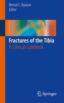 Fractures of the Tibia : A Clinical Casebook