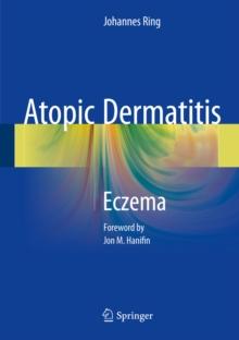 Atopic Dermatitis : Eczema