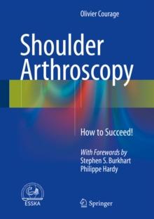 Shoulder Arthroscopy : How to Succeed!