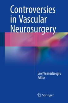 Controversies in Vascular Neurosurgery