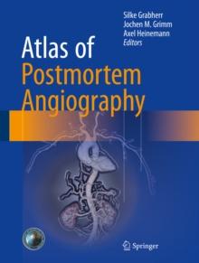 Atlas of Postmortem Angiography