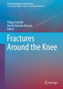 Fractures Around the Knee