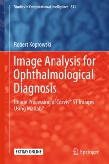 Image Analysis for Ophthalmological Diagnosis : Image Processing of Corvis(R) ST Images Using Matlab(R)