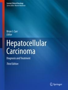 Hepatocellular Carcinoma : Diagnosis and Treatment