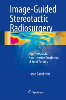 Image-Guided Stereotactic Radiosurgery : High-Precision, Non-invasive Treatment of Solid Tumors