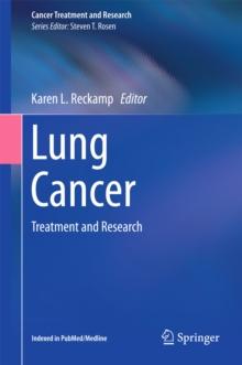 Lung Cancer : Treatment and Research