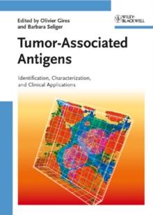 Tumor-Associated Antigens : Identification, Characterization, and Clinical Applications