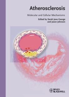 Atherosclerosis : Molecular and Cellular Mechanisms