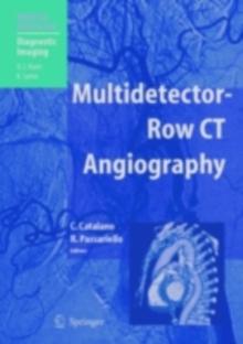 Multidetector-Row CT Angiography