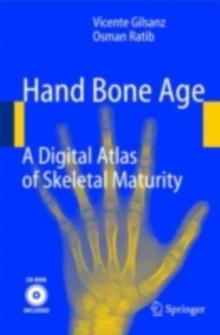 Hand Bone Age : A Digital Atlas of Skeletal Maturity